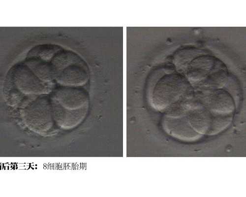 香港验血男女超过8周还准吗_香港验血复检流程_实例分享看完你还做吗!