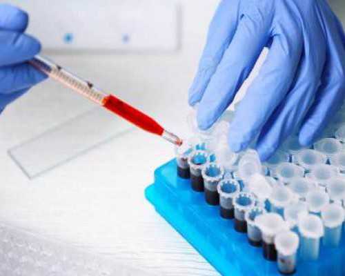 自己到香港验血测男女_香港b超查男女多少钱_验血需要满足哪些条件