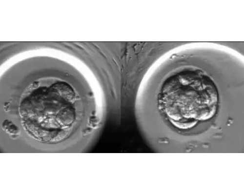 验血寄到香港靠谱吗_邮寄到香港验血多少钱?我的阅历，给你更多的惊喜!