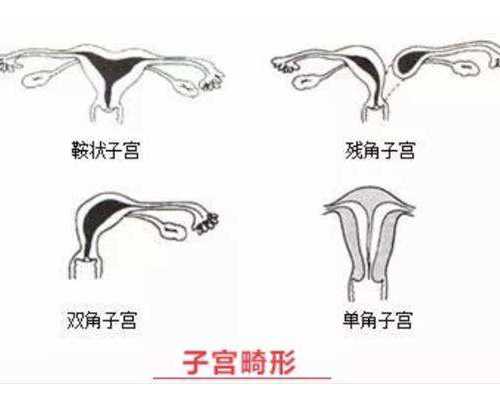 香港验血看男宝女宝准吗_香港胎儿性别鉴定结果怎么看,宝妈分享两次验血经历