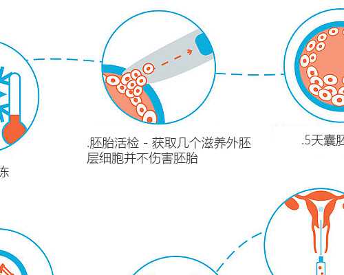 古玩市场铜钱多少钱一枚_栗宪庭:艺术家必须永远坚持你个人的感觉
