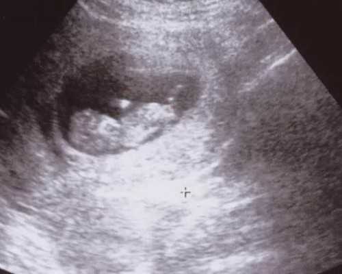 寄血去香港验血都是女孩_香港怀孕几个月可以查男女的_哪家验血机构比较好