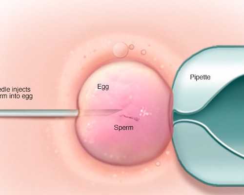 香港验血测男女是验dna吗_香港验血双胎验的准吗_性别鉴定真会翻盘吗
