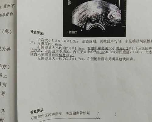 香港验血性别真的假的_香港DNA查看哪里好,验血查男女只需2600被骗了