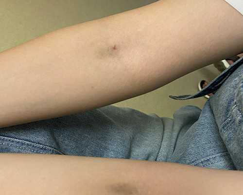 香港医院验血测性别多少钱_香港早孕验血报告单准不准_验血是什么原理原来都