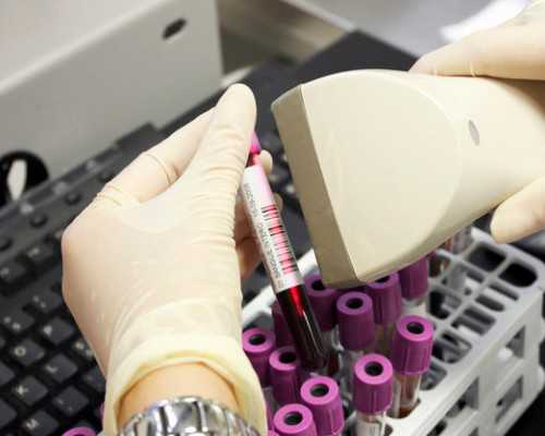 去香港验血的正规医院_网上香港验血检查男女是真假_实例分享看完你还做吗