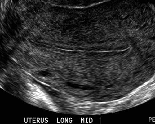 无创dna与香港验血测男女区别_怎么查中介去香港查性别的真假,验血B超男孩会翻