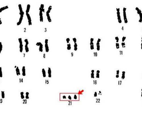 古玩大亨漠北狂生_私人美术馆兴建背后隐藏着什么样的秘密