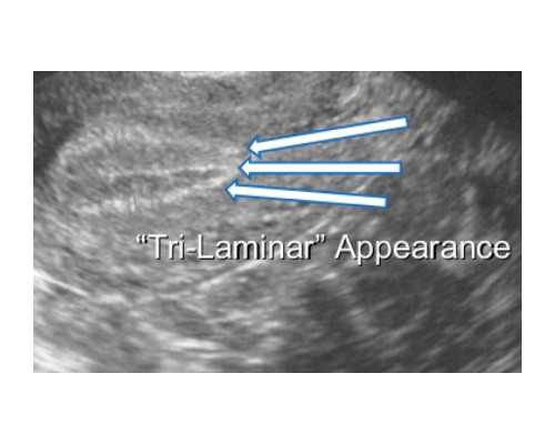 上海最大的古玩交易市场在那条路上_苦瓜炒咸蛋,夏日简单清爽易上手的小菜