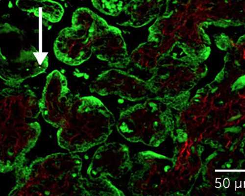 怀孕6周香港可以验血吗_香港验血查性别丬到柏新医疗_选择哪家化验所好!