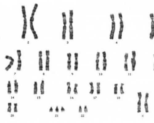 银川寄往香港验血中介_孕10周到香港验血_鉴定性别哪家医院最正规!