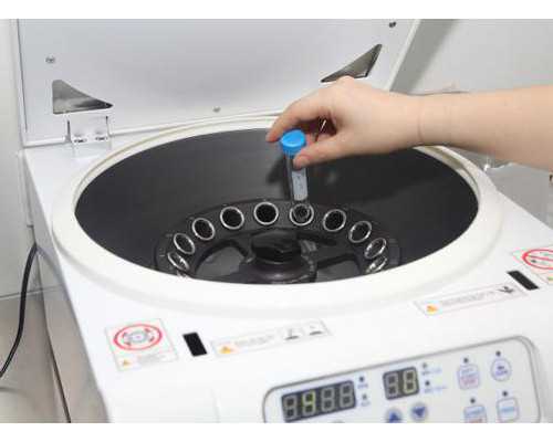 香港 验血 费用_香港验血报告单pg_验血测男女可不可靠流程手续如何!