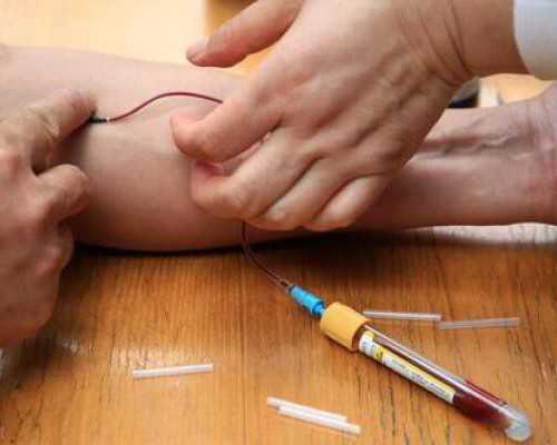 古玩艺术品交易上门收购_春天吃种子可保护生机