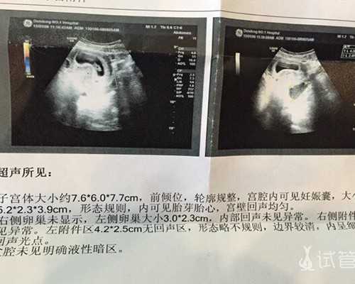 现代古玩电视剧大全_男士肩肌速成训练秘诀