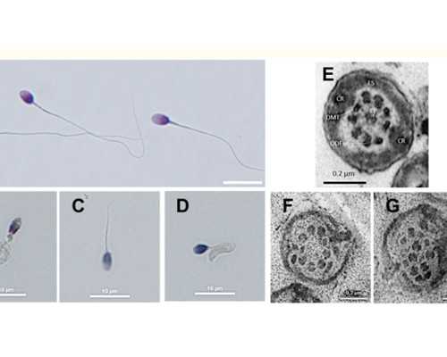输卵管介入治疗的方法有哪些~代孕生男孩费用