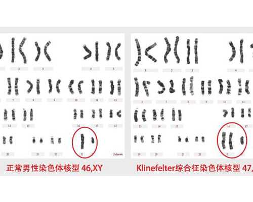 香港卓信医疗验血费用_“流连忘返”与“留恋忘返”的区别是什么?流连忘返