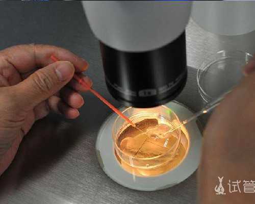 香港验血多少周准确啊哪天开始算_怀孕去香港验血准吗_分享一下本人亲身经历