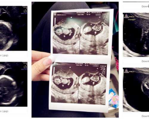 中介去香港验血准吗_宝宝性别香港验血,预约香港鉴定性别需要什么流程