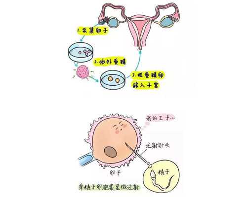 古董古玩鉴定交易平台_巴黎绘画周：重返一个由中国主导的艺术市场