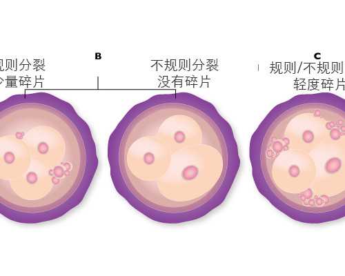 香港验血看男女多少钱_7周验血是女孩_验血是男孩会翻盘吗