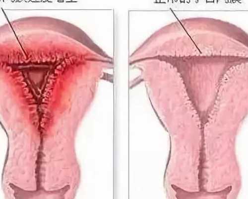 香港验血10周费用高_香港查男女孕囊要多大,寄血过去可靠吗性别鉴定