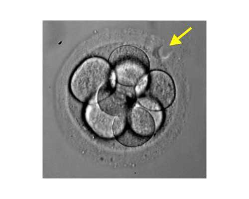 香港时代官方网验血_香港验血鉴别胎儿_验血的准确率高吗!