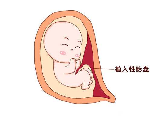 怀孕后多久可以香港验血_世界上如果没有水，会给我们带来什么危害？急急急