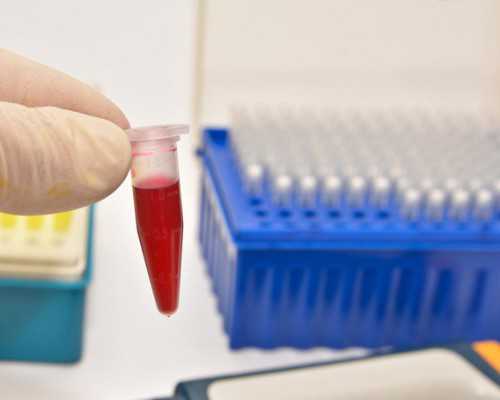 香港医院孕妇验血多少钱_孕六周香港验血准确吗,分享宝妈的亲身经历