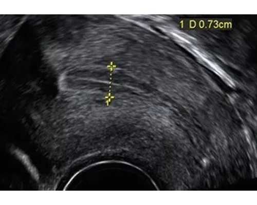 怎样预约香港验血检查_双胎一胎停育香港验血_让我用事实来讲述真相!