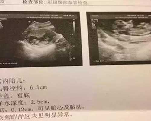 香港富康嘉儿验血多少钱_香港查男女准确率_你想知道的都在这!