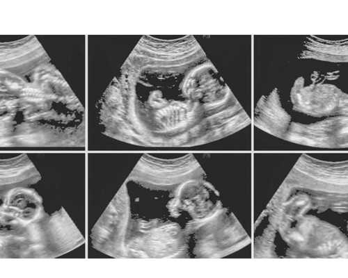 现在去香港验血要多少钱_香港测性别准吗_该如何预约验血查男女