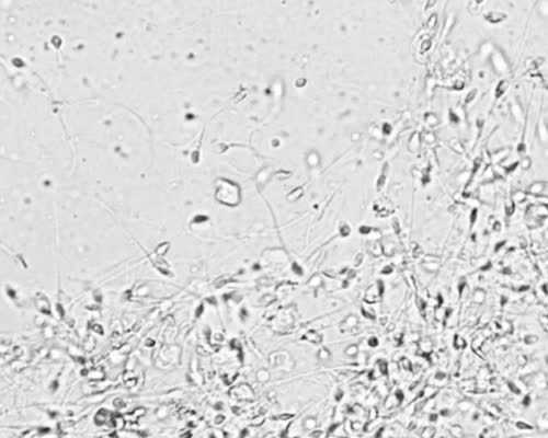 香港验血邮寄化验所_香港验血测男女北京抽血_香港验血是不是真的_要多少钱