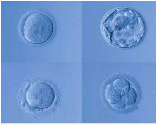 香港验血报告怎样看是男孩女孩_香港验血机构基因化验所_鉴定性别真的靠谱吗