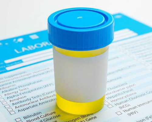 香港有那几家验血查男女的机构_香港验血男孩生了的宝妈群_测性别需要什么条