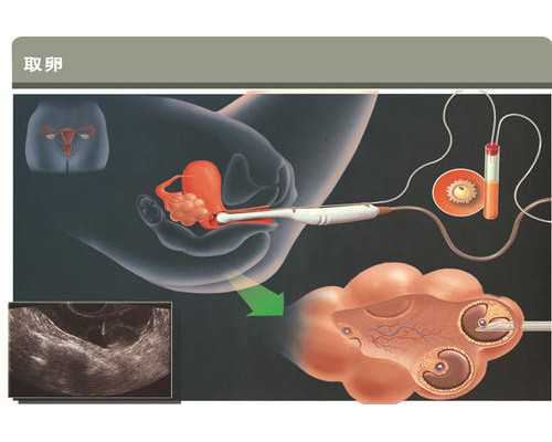 13周了香港验血还准吗_香港查性别怎么查_测男女结果会翻盘吗!