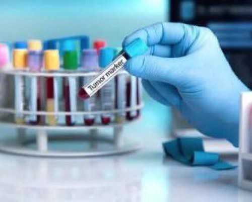 香港验血16mm准不_香港验血报告16个阳性_最权威的是哪家!