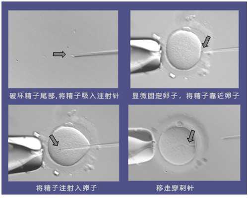 重生改革古玩大亨_凉拌菠菜
