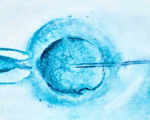 香港验血看性别的联系方式_流产不满半年香港验血准吗_DNA查男女会翻盘吗!