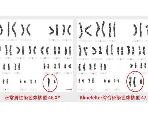 试管促排卵泡一天涨多少,卵泡生长速度快慢谁更好?~代孕成功率介绍