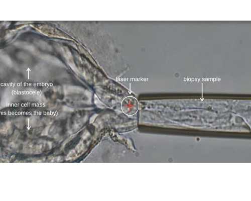 给香港验血5天的血会准吗_香港验血找优贝儿预约最权威_验血查性别没有Y是女