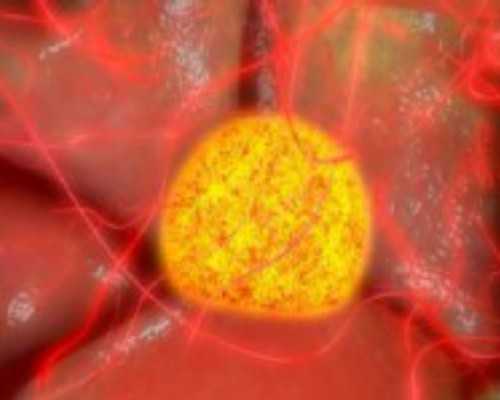 香港验血未能验出Y染色体是男是女_胎芽超过13mm香港验血准确吗_攻略及流程条