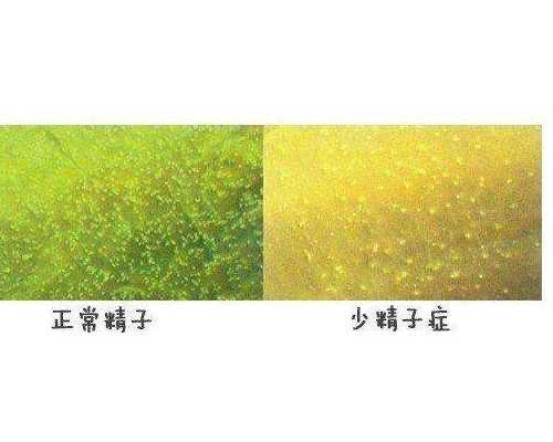 香港达雅高验血测男女准吗_香港验血复检是有y吗_验血准确率(价格、攻略、怎