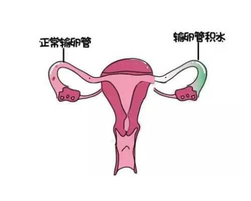 科普:国内验血查男女有没有这技术?过来人来告诉,香港胎儿验血费用多少钱