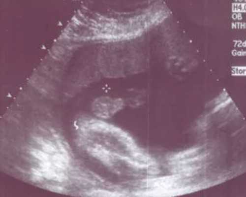 在香港验血验男女要多少钱,香港验血有翻盘都没_鉴定性别哪个化验所最准确