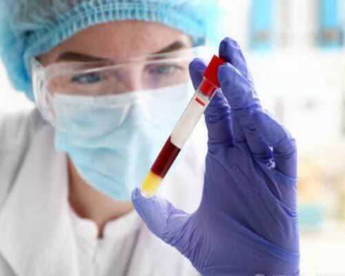 古玩鉴定需要多少钱,梦见死人好不好,有什么含义