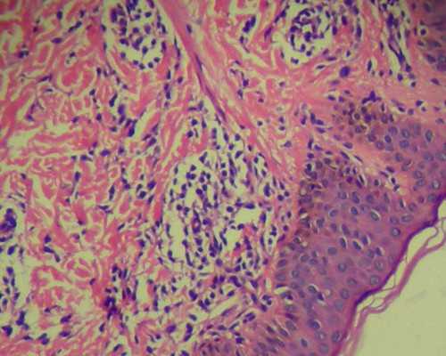 香港验血孕妇血样浓度低,香港怀孕验血_你想知道的这里都有!