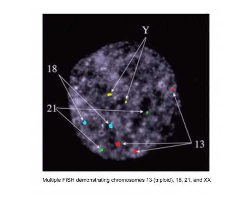 大陆人 可以到香港验血鉴定男女,香港最早几周可以查男女_查男女需要准备什么