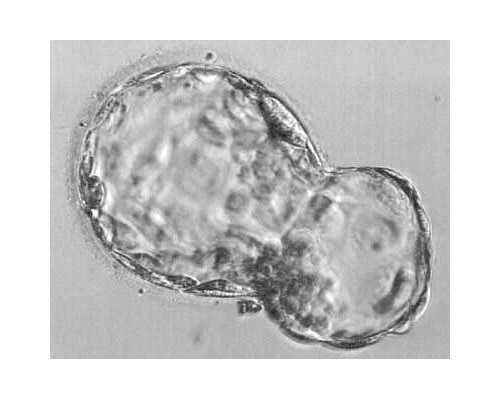 剖腹产后恶露少怎么回事,香港验血卓信诊所HK2073