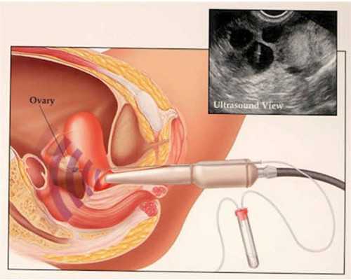 朝天宫古玩市场电话,女性尿酸高的原因