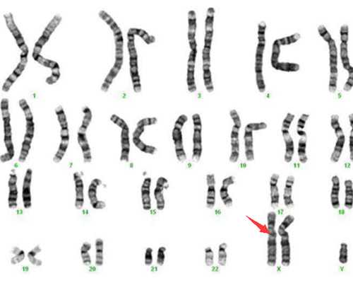 古玩骗局电影,人生格局有多重要？同一夜成名，贾玲狂揽30亿，白凯南自毁前途